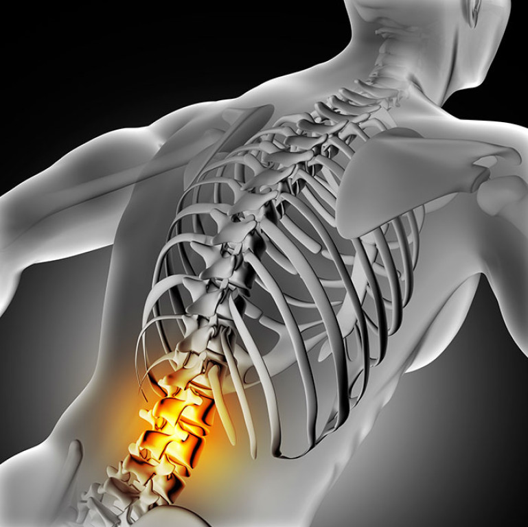 Pincement discal les causes et les solutions